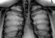 Radiografie ULUITOARE! Medicii au rămas FĂRĂ CUVINTE după ce au văzut asta