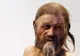 Otzi, omul ghețurilor, suferea de ateroscleroză