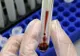 Sute de analize medicale pentru depistarea HIV, falsificate la Spitalul Judeţean din Tg.Jiu