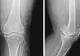 Ce au descoperit medicii în genunchii unei femei. N-au mai văzut așa ceva în toată cariera lor