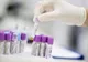 Un nou test de depistare a cancerului de col uterin, lansat pe piaţă