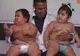 BEBELUŞII care au ŞOCAT medicii: cântăresc peste 20 de kg, la doar 10 luni