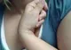 O afecţiune de care suferă mii de români nu este inclusă în programul național al bolilor rare