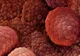 Medicamentul care previne cea mai agresiva forma de cancer