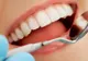 Locul din lume unde o extracție dentară costă mai puțin de 3 lei