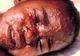 Boala care face ravagii în Africa și dă fiori Europei. E EPIDEMIE!