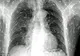 Acuza dureri de stomac şi a mers la doctor pentru un control de rutină. Ce a aflat este cutremurător