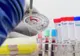 TEST RAPID pentru depistarea EBOLA