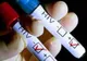 AUDIERI în cazul tânărului din Segarcea care AR FI INFECTAT CU HIV mai multe persoane