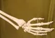 ELEVII dintr-o şcoală din România învaţă anatomie pe SCHELETUL FOSTULUI DIRECTOR 