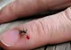 Un cartier din Craiova, ÎN CARANTINĂ din cauza virusului West Nile