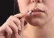 Tratamente naturiste pentru herpes