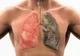 Fumezi? Aceasta este substanța toxică care râmâne în plămânii tăi 40 de ani