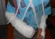 Incident şocant, la Cluj: după ora de sport, un elev de clasa a III-a are ambele mâini fracturate