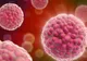 Simptome mai puţin ştiute care anunţă cancerul la femei