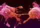 Descoperire. Un tratament revoluționar împotriva cancerului a dat rezultate excepționale