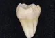 Cum explică psihologii frica de dentist. Află când s-a făcut primul tratament stomatologic