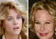 Meg Ryan, desfigurată de operaţiile estetice!