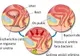 Cum să scapi de infecţia urinară cu acest suc miraculos