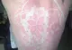 "Tatuajele solare", noul trend care face ravagii pe internet 