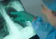 12 paşi ca să te fereşti de cancer, potrivit experţilor