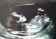 Era însărcinată și la ecografie a văzut ceva șocant în burta sa. Doctorii au rămas fără cuvinte
