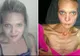 A primit o scrisoare de la mama ei. Vestea cumplită care a făcut-o să ajungă la doar 34 kg