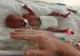 Când s-a născut, avea 500 de grame şi toţi credeau că va muri. Apoi, un miracol s-a petrecut