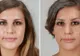 Ştiai ce urme îţi poate lăsa fumatul pe faţă? Trebuie să vezi asta! 