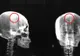 Şocant. Ce au găsit medicii în creierul unei femei care se plângea des de migrene