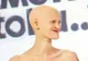Când s-a născut, această fată a primit un diagnostic dur. Acum, povestea ei inspiră întreaga lume