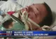 A ieşit în pauză să fumeze, dar ce s-a petrecut i-a schimbat viaţa. Acum nu poate mânca nimic
