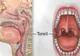 Amestecul care vindecă gâtul inflamat în doar două ore