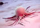 Medicii au găsit soluţia. Cele mai bune 10 metode de a preveni cancerul