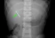 I-au făcut o radiografie copilului lor și au descoperit ceva ȘOCANT