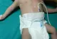 Minune sau blestem? Un bebeluș s-a născut cu două capete. Medicii sunt șocați