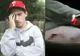 Şocul medicilor, după ce un tânăr student s-a plâns de dureri de cap. Ce au găsit în creierul său