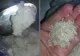 Orezul din plastic, un adevărat pericol pentru sănătate