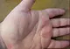 Primul semn de cancer apare pe mâini. NU îl ignora!