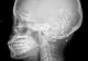 Când au văzut această radiografie, medicii au încremenit. Ce păţise pacienta