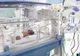 Siamezele din Constanţa suferă de malformaţii severe 