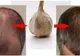 Usturoiul, cel mai bun remediu natural împotriva căderii părului. Ce trebuie să faci