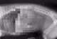 Radiografia care provoacă fiori pe șira spinării. Te cutremuri când o privești cu atenție