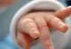 Siamezele din Constanţa, abandonate în spital de mamă