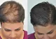 Se prepară cu ingrediente pe care le găsești în bucătărie.Remediul eficient pentru creșterea părului