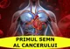 Atenție! Nu ignora! Primul semn al cancerului! Verifică aici