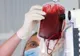La un pas de moarte. Medicii l-au tratat cu orez! Povestea unui tânăr din Iaşi plimbat între spitale