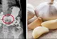 A mâncat usturoi cu miere pe stomacul gol, timp de 7 zile. Efectele au fost peste așteptările ei