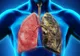 Medicamentul natural al dacilor protejează stomacul și plămânii, tratează infecțiile și rinichii