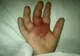 Copil paralizat, după ce a mâncat un fruct pe care toți micuții îl consumă
